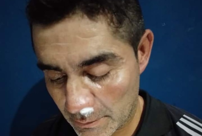 Hinchas de Unión golpearon al DT de Peñaflor y el partido fue suspendido